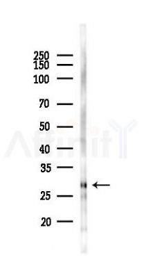 CLEC1B Antibody - Western blot analysis of lysates from HUVEC cells(starvation 24h treatment), using CLEC1B Antibody at 1/1000 dilution.