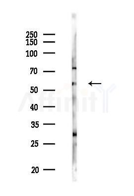 RSL1D1 Antibody - Western blot analysis of lysates from PC12 cells(LPS 4h treatment), using RSL1D1 Antibody at 1/1000 dilution.