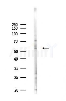 RSL1D1 Antibody - Western blot analysis of lysates from RAW264.