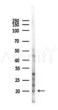 Chemerin Antibody - Western blot analysis of lysates from HUVEC cells(starvation 24h treatment), using Chemerin Antibody at 1/1000 dilution.