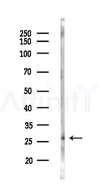 SPNXA Antibody - Western blot analysis of lysates from HUVEC cells(LPS 4h treatment), using SPNXA Antibody at 1/1000 dilution.