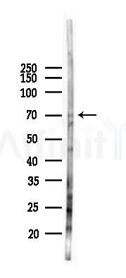 DDX41 Antibody - Western blot analysis of lysates from RAW264.