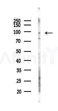 Prickle 2 Antibody - Western blot analysis of lysates from EC304 cells(heat-shock 45min treatment), using Prickle 2 Antibody at 1/1000 dilution.