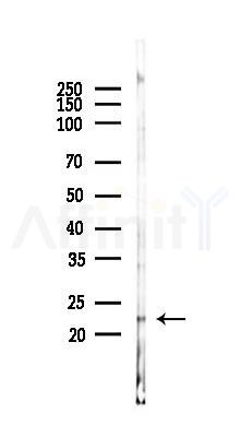 ARPC4 Antibody - Western blot analysis of lysates from RAW264.