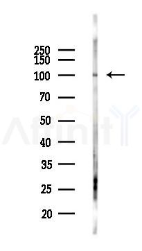 VPS18 Antibody - Western blot analysis of lysates from EC304 cells(heat-shock 45min treatment), using VPS18 Antibody at 1/1000 dilution.