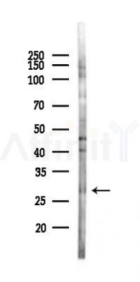 WFDC1 Antibody - Western blot analysis of lysates from HUVEC cells(starvation 24h treatment), using WFDC1 Antibody at 1/1000 dilution.