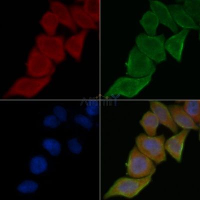 Arginyl tRNA synthetase Antibody - DF14426 staining Hela cells(45min of heat-shock treatment) by IF/ICC.