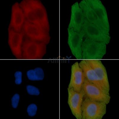 PGS1 Antibody - DF14440 staining Hela cells(30min of UV treatment) by IF/ICC.