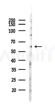 KLRG1 Antibody - Western blot analysis of lysates from B16F10-LUC cells(heat-shock 45min treatment), using KLRG1 Antibody at 1/1000 dilution.