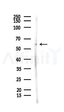 KLRG1 Antibody - Western blot analysis of lysates from Rat brain, using KLRG1 Antibody at 1/1000 dilution.