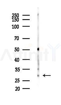 R-spondin1 Antibody - Western blot analysis of lysates from Mouse lung, using R-spondin1 Antibody at 1/1000 dilution.