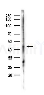 TBX1 Antibody - Western blot analysis of lysates from HUVEC cells(LPS 4h treatment), using TBX1 Antibody at 1/1000 dilution.