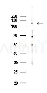 ZMIZ1 Antibody - Western blot analysis of lysates from HUVEC cells(LPS 4h treatment), using ZMIZ1 Antibody at 1/1000 dilution.