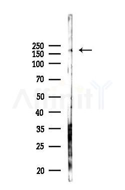 PBRM1 Antibody - Western blot analysis of lysates from B16F10-LUC cells(heat-shock 45min treatment), using PBRM1 Antibody at 1/1000 dilution.