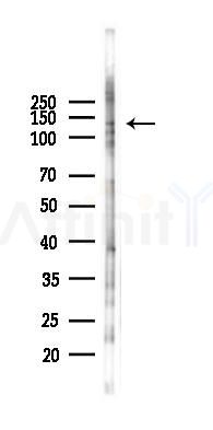 RBP3 Antibody - Western blot analysis of lysates from PC12 cells(LPS 4h treatment), using RBP3 Antibody at 1/1000 dilution.