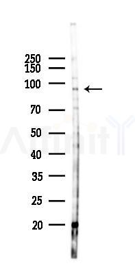 DEPDC1 Antibody - Western blot analysis of lysates from B16F10-LUC cells(heat-shock 45min treatment), using DEPDC1 Antibody at 1/1000 dilution.
