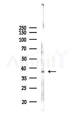 ANP32E Antibody - Western blot analysis of lysates from 293 cells(UV 30min treatment), using ANP32E Antibody at 1/1000 dilution.
