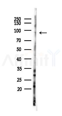 PDE8A Antibody - Western blot analysis of lysates from HUVEC cells(LPS 4h treatment), using PDE8A Antibody at 1/1000 dilution.