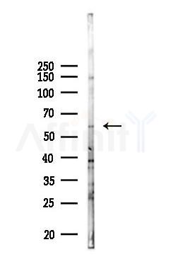 AMY2A Antibody - Western blot analysis of lysates from 293 cells(UV 30min treatment), using AMY2A Antibody at 1/1000 dilution.