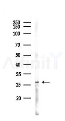 BEX3 Antibody - Western blot analysis of lysates from Hela cells(heat-shock 45min treatment), using BEX3 Antibody at 1/1000 dilution.