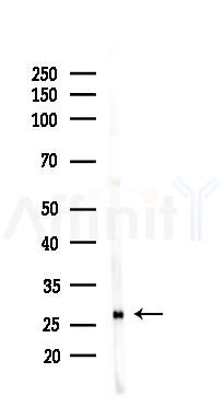 BEX3 Antibody - Western blot analysis of lysates from 293 cells(heat-shock 45min treatment), using BEX3 Antibody at 1/1000 dilution.