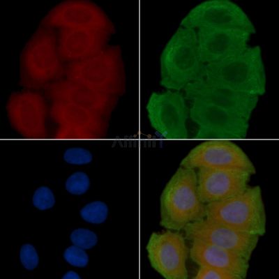 MOAP1 Antibody - DF14507 staining Hela cells(30min of UV treatment) by IF/ICC.