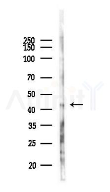 EAF2 Antibody - Western blot analysis of lysates from Hela cells(heat-shock 45min treatment), using EAF2 Antibody at 1/1000 dilution.