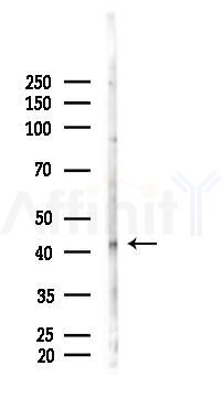 EAF2 Antibody - Western blot analysis of lysates from 293 cells(heat-shock 45min treatment), using EAF2 Antibody at 1/1000 dilution.