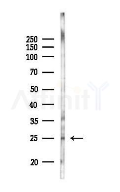 PAIP2 Antibody - Western blot analysis of lysates from B16F10-LUC cells(heat-shock 45min treatment), using PAIP2 Antibody at 1/1000 dilution.