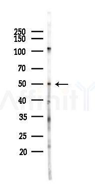 RCOR2 Antibody - Western blot analysis of lysates from HUVEC cells(LPS 4h treatment), using RCOR2 Antibody at 1/1000 dilution.