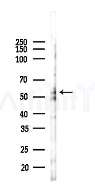 BAIAP2 Antibody - Western blot analysis of lysates from PC12 cells(LPS 4h treatment), using BAIAP2 Antibody at 1/1000 dilution.