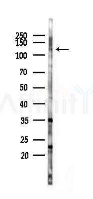 USP25 Antibody - Western blot analysis of lysates from HUVEC cells(LPS 4h treatment), using USP25 Antibody at 1/1000 dilution.