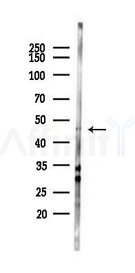 SIGLEC6 Antibody - Western blot analysis of lysates from HUVEC cells(LPS 4h treatment), using SIGLEC6 Antibody at 1/1000 dilution.