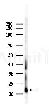 GUCA1A Antibody - Western blot analysis of lysates from B16F10-LUC cells(heat-shock 45min treatment), using GUCA1A Antibody at 1/1000 dilution.