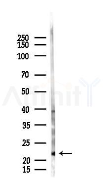GUCA1A Antibody - Western blot analysis of lysates from Rat brain, using GUCA1A Antibody at 1/1000 dilution.