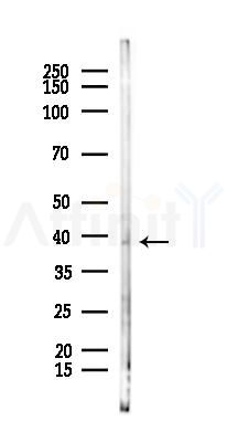 HAVCR1 Antibody - Western blot analysis of lysates from Mouse lung, using HAVCR1 Antibody at 1/1000 dilution.