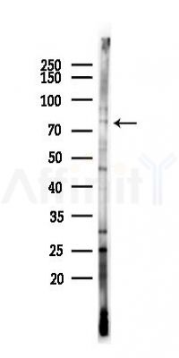 ZBED1 Antibody - Western blot analysis of lysates from HUVEC cells(LPS 4h treatment), using ZBED1 Antibody at 1/1000 dilution.