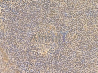 KLHL26 Antibody - DF14572 at 1/100 staining human normal tonsil tissue by IHC-P.
