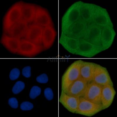 KLHL26 Antibody - DF14572 staining Hela cells(30min of UV treatment) by IF/ICC.