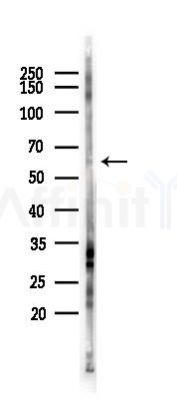 CACNB2 Antibody - Western blot analysis of lysates from HUVEC cells(LPS 4h treatment), using CACNB2 Antibody at 1/1000 dilution.