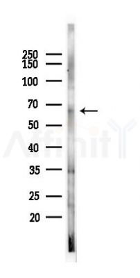 CPEB2 Antibody - Western blot analysis of lysates from HUVEC cells(LPS 4h treatment), using CPEB2 Antibody at 1/1000 dilution.