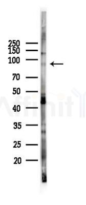 DACT1 Antibody - Western blot analysis of lysates from PC12 cells(LPS 4h treatment), using DACT1 Antibody at 1/1000 dilution.