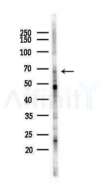 MAN1A1 Antibody - Western blot analysis of lysates from HUVEC cells(LPS 4h treatment), using MAN1A1 Antibody at 1/1000 dilution.