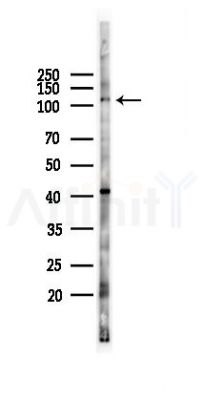 JADE2 Antibody - Western blot analysis of lysates from PC12 cells(LPS 4h treatment), using JADE2 Antibody at 1/1000 dilution.