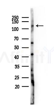 JADE2 Antibody - Western blot analysis of lysates from HUVEC cells(LPS 4h treatment), using JADE2 Antibody at 1/1000 dilution.