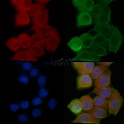 DUT Antibody - DF14617 staining Hela cells(45min of heat-shock treatment) by IF/ICC.