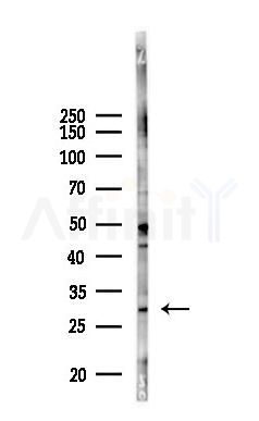 KCNIP2 Antibody - Western blot analysis of lysates from 293 cells(UV 30min treatment), using KCNIP2 Antibody at 1/1000 dilution.