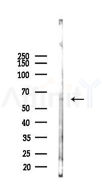 LGI2 Antibody - Western blot analysis of lysates from EC304 cells(starvation 24h treatment), using LGI2 Antibody at 1/1000 dilution.