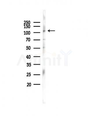 SLITRK5 Antibody - Western blot analysis of lysates from PC12 cells(LPS 4h treatment), using SLITRK5 Antibody at 1/1000 dilution.
