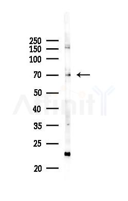 UNC93B1 Antibody - Western blot analysis of lysates from B16F10-LUC cells(heat-shock 45min treatment), using UNC93B1 Antibody at 1/1000 dilution.